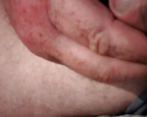 Flash am strand free ...